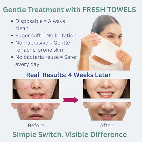 FRESHist Disposable Face Towels 300 Ct 6 Packs
