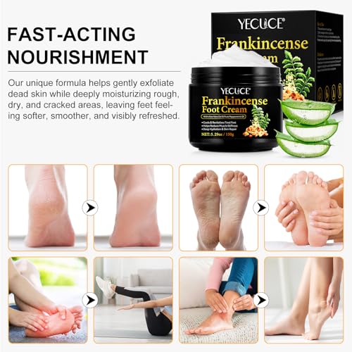 Frankincense Foot Cream 529oz for Deep Moisturizing