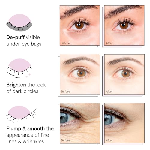 Grace Stella Under Eye Patches 12 Pairs - Dark Circles Puffiness Eye Masks
