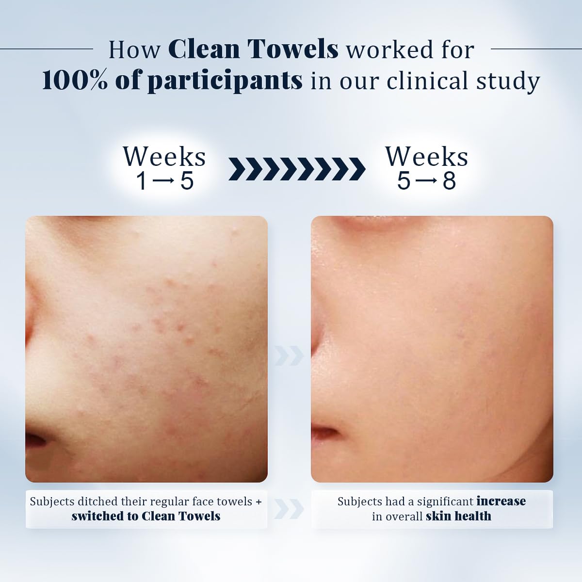 DewVera Disposable Face Towel 10x12 Ultra Soft Thick Washcloth