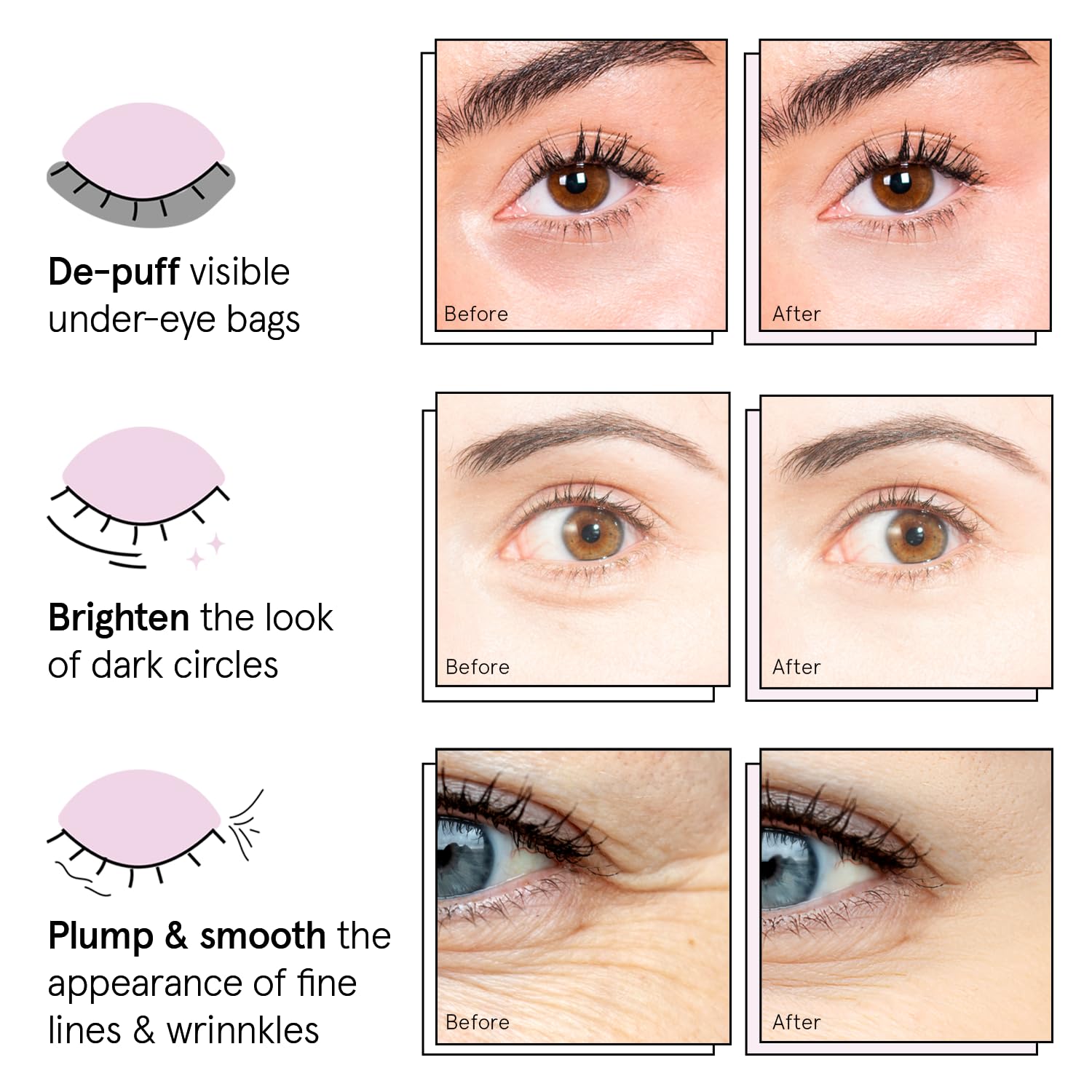 Grace Stella Under Eye Patches 12 Pairs - Dark Circles Puffiness Eye Masks